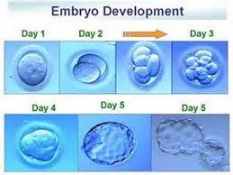 Causes of Female Infertility