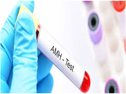 AMH Test in a female for IVF