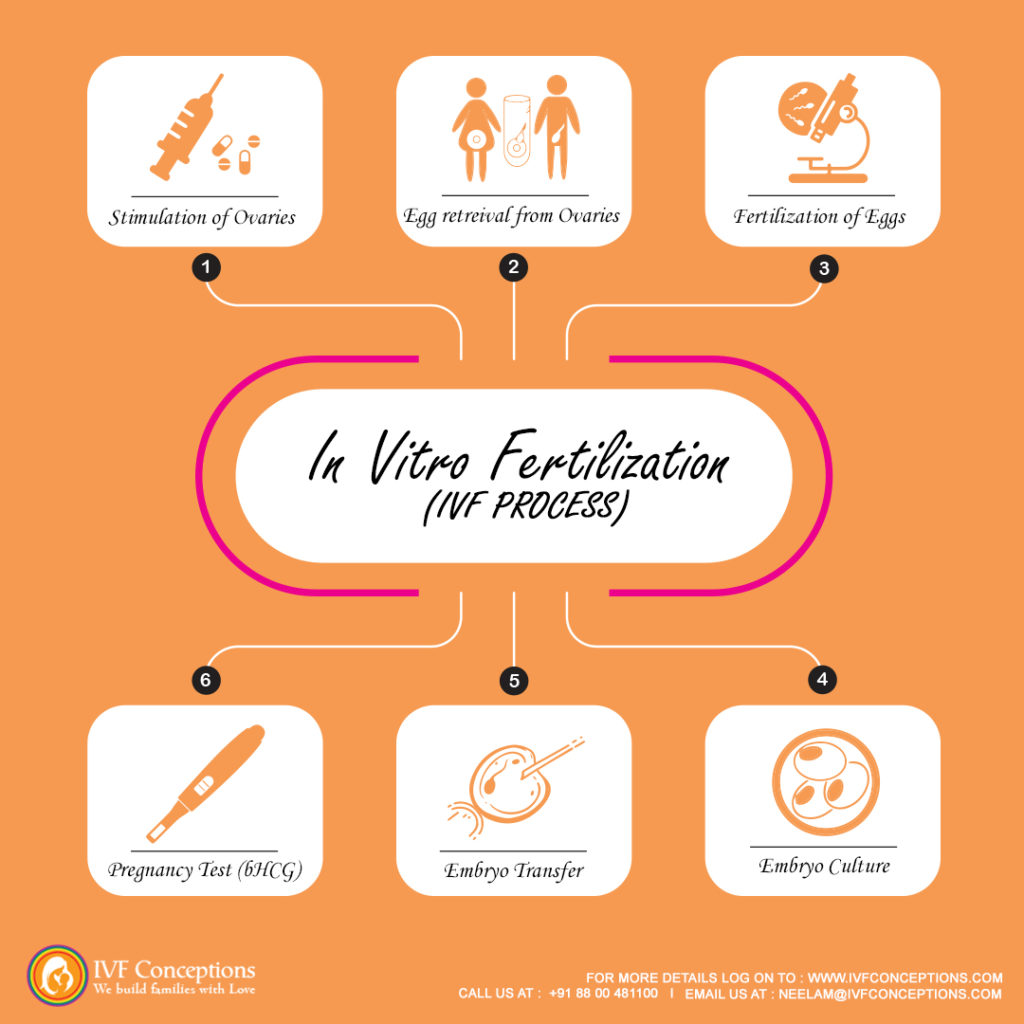 How does IVF process work?