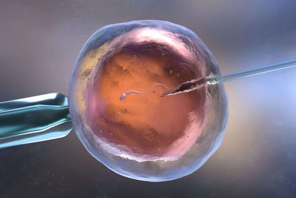 IVF Process- sperm DNA fragmentation 