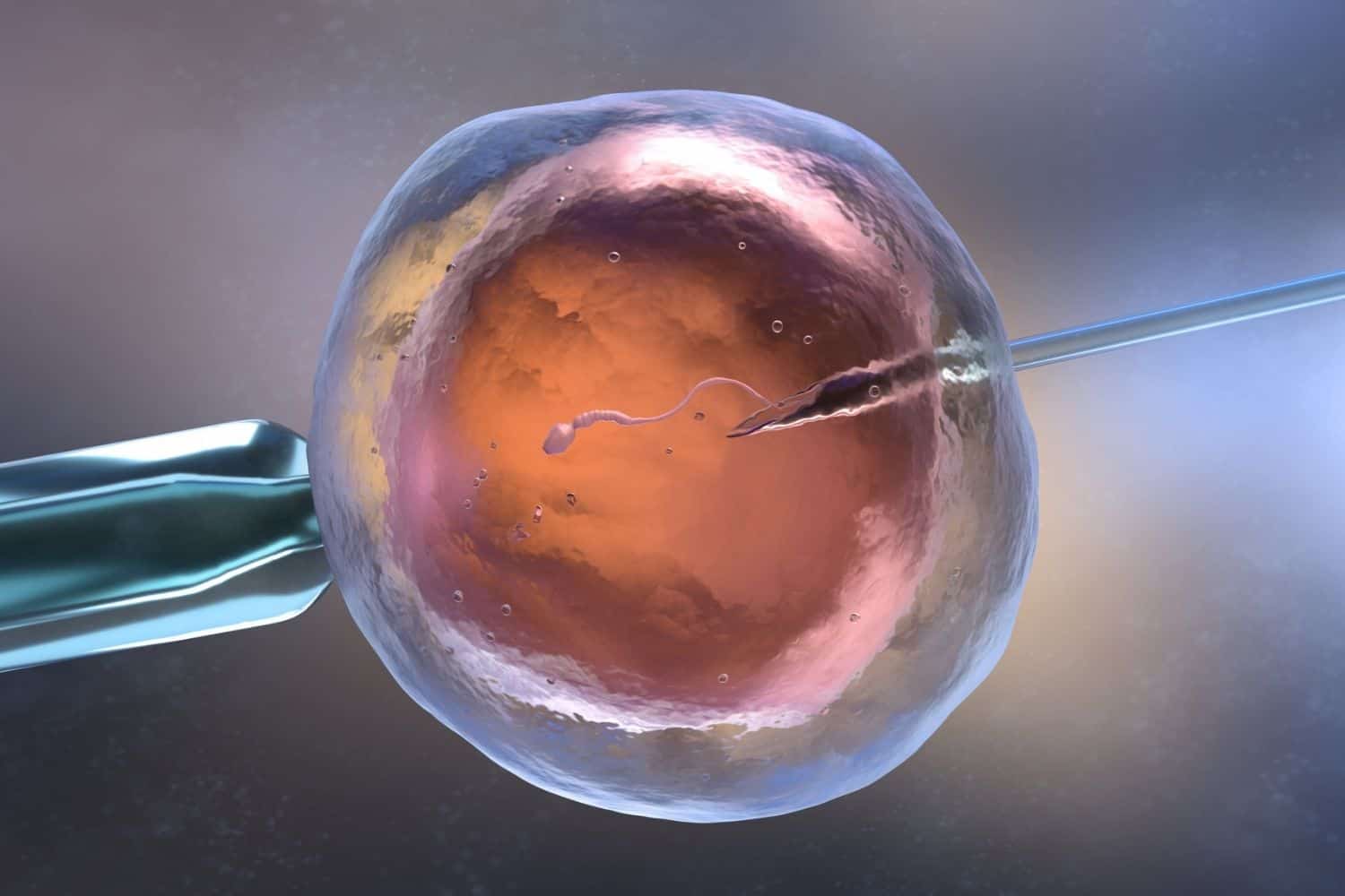 IVF Process