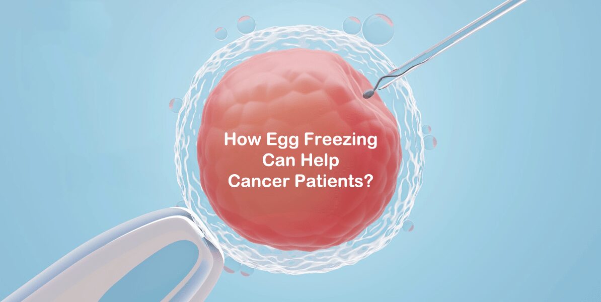 Egg Freezing for Cancer Patients
