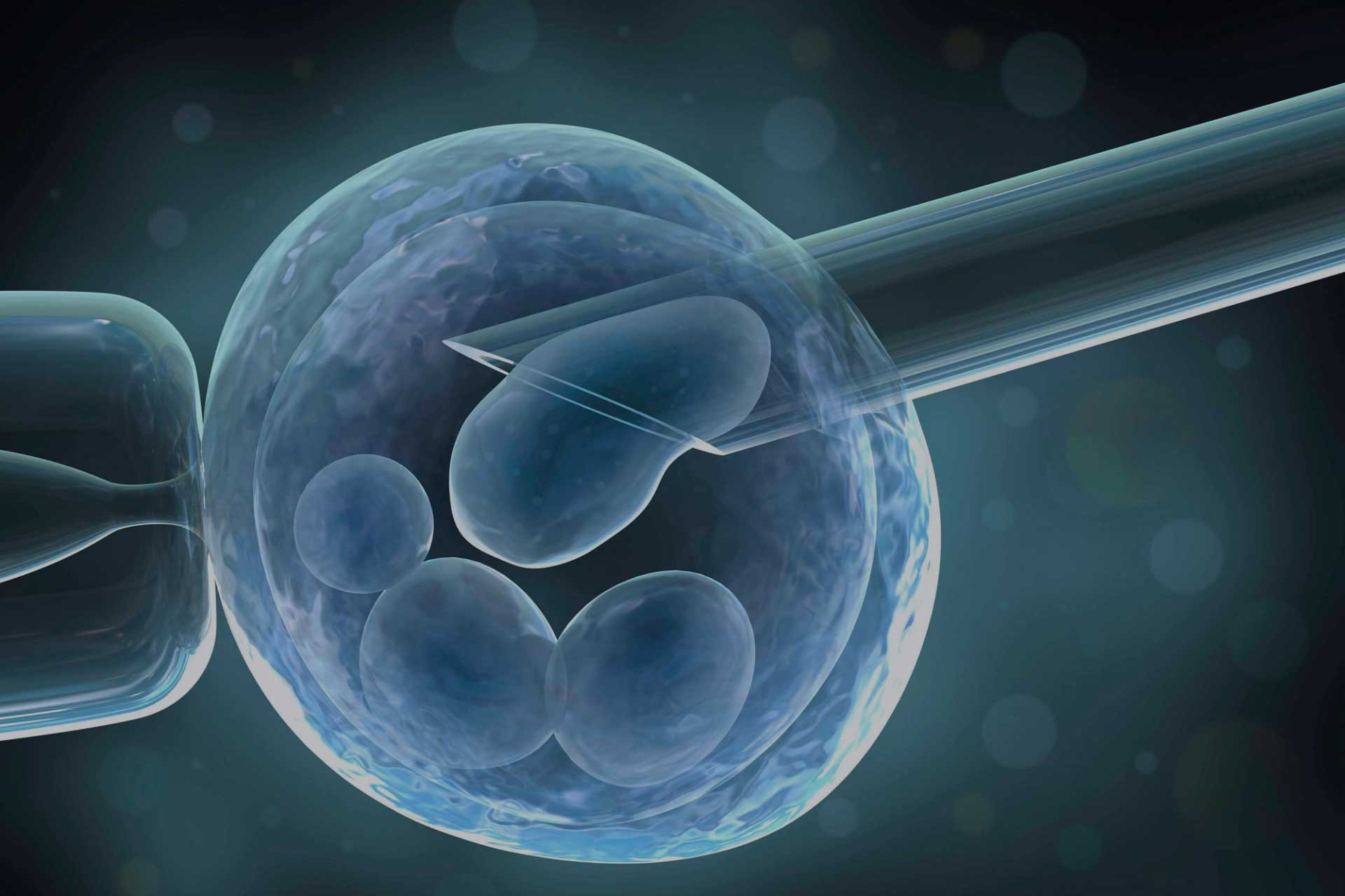 In Vitro Fertilization