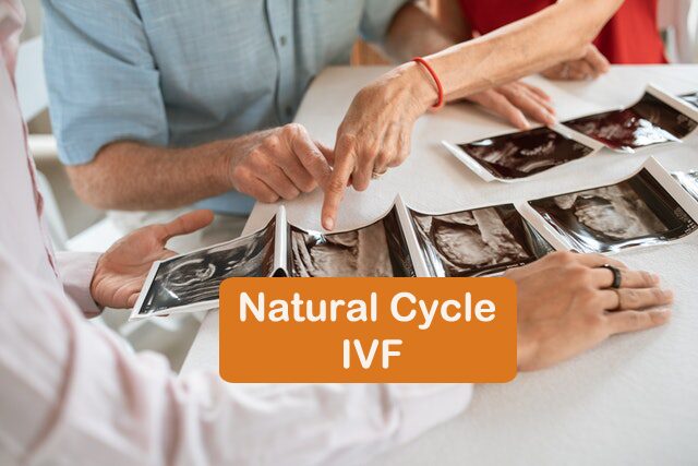 Natural Cycle IVF