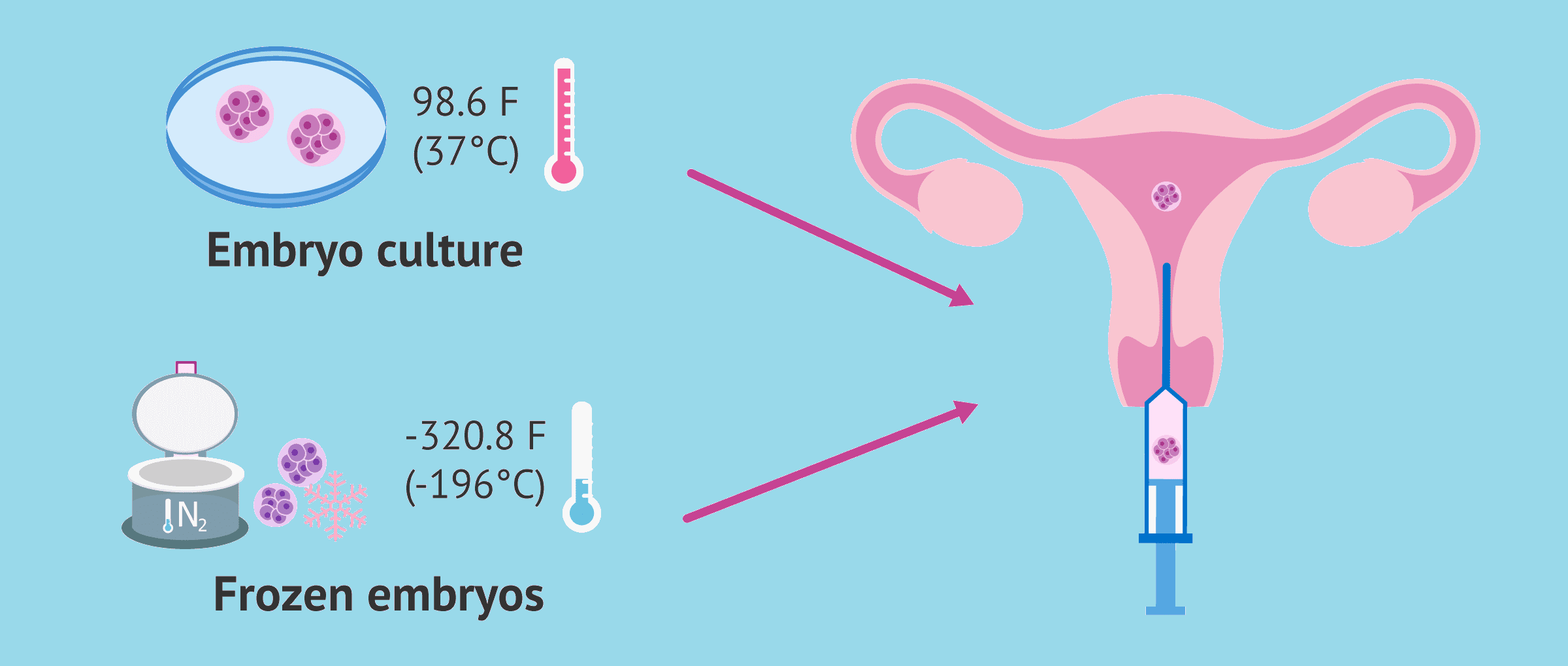 Cryopreservation of embryos 